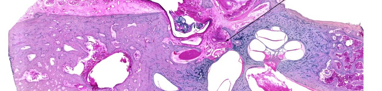 Schůze České společnosti otorinolaryngologie a&nbsp;chirurgie hlavy a&nbsp;krku ČLS JEP Královéhradeckého a&nbsp;Pardubického regionu